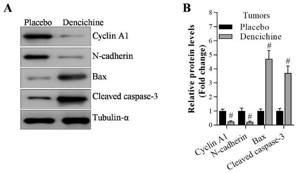 Application of Dencichine in preparation of biological medicine preparation for treating lung cancer