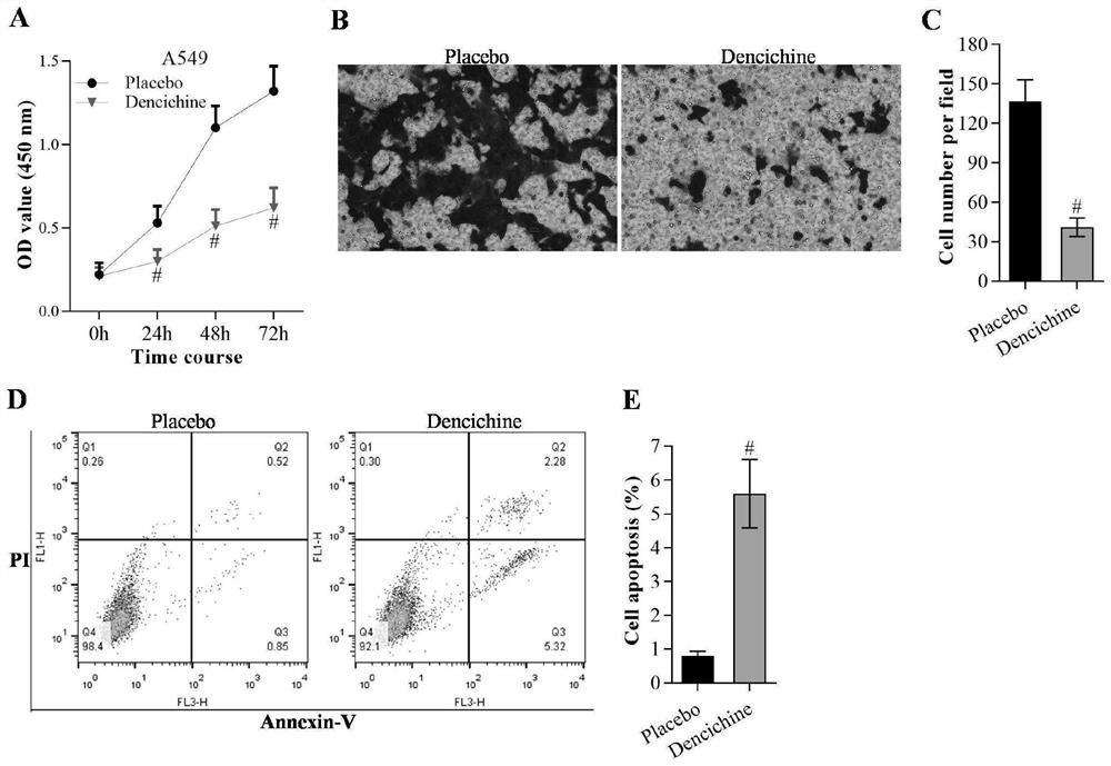 Application of Dencichine in preparation of biological medicine preparation for treating lung cancer