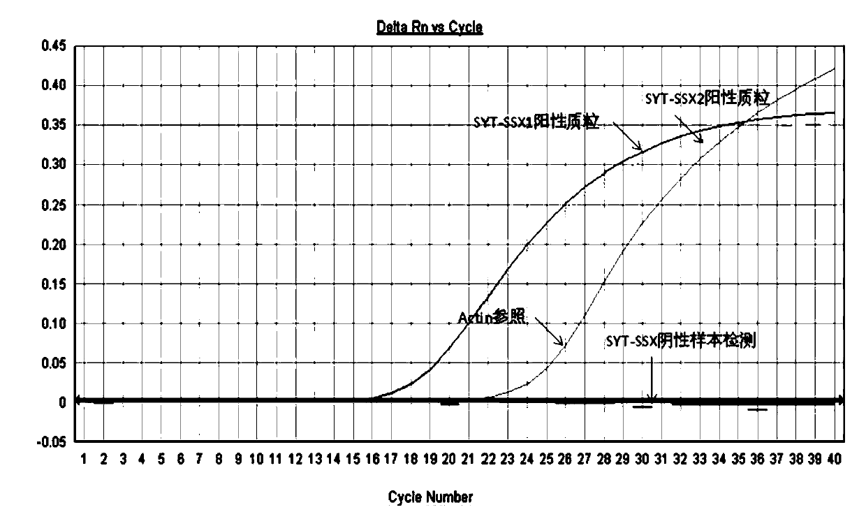 Primers, kit and method for detecting SYT-SSX fusion genes