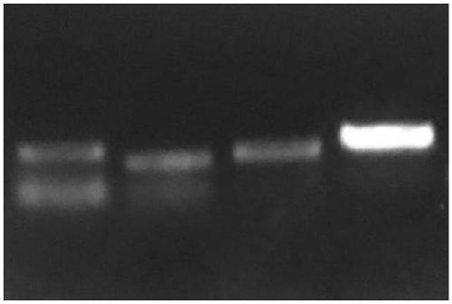 Biomarker for saliva test of 2019-nCoV and application of biomarker