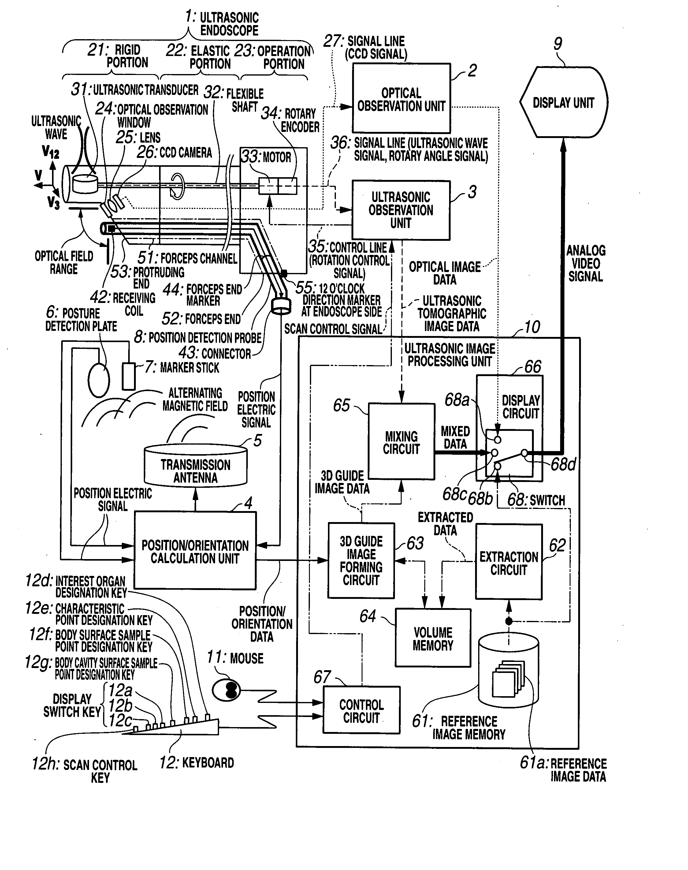 Ultrasonic diagnostic apparatus