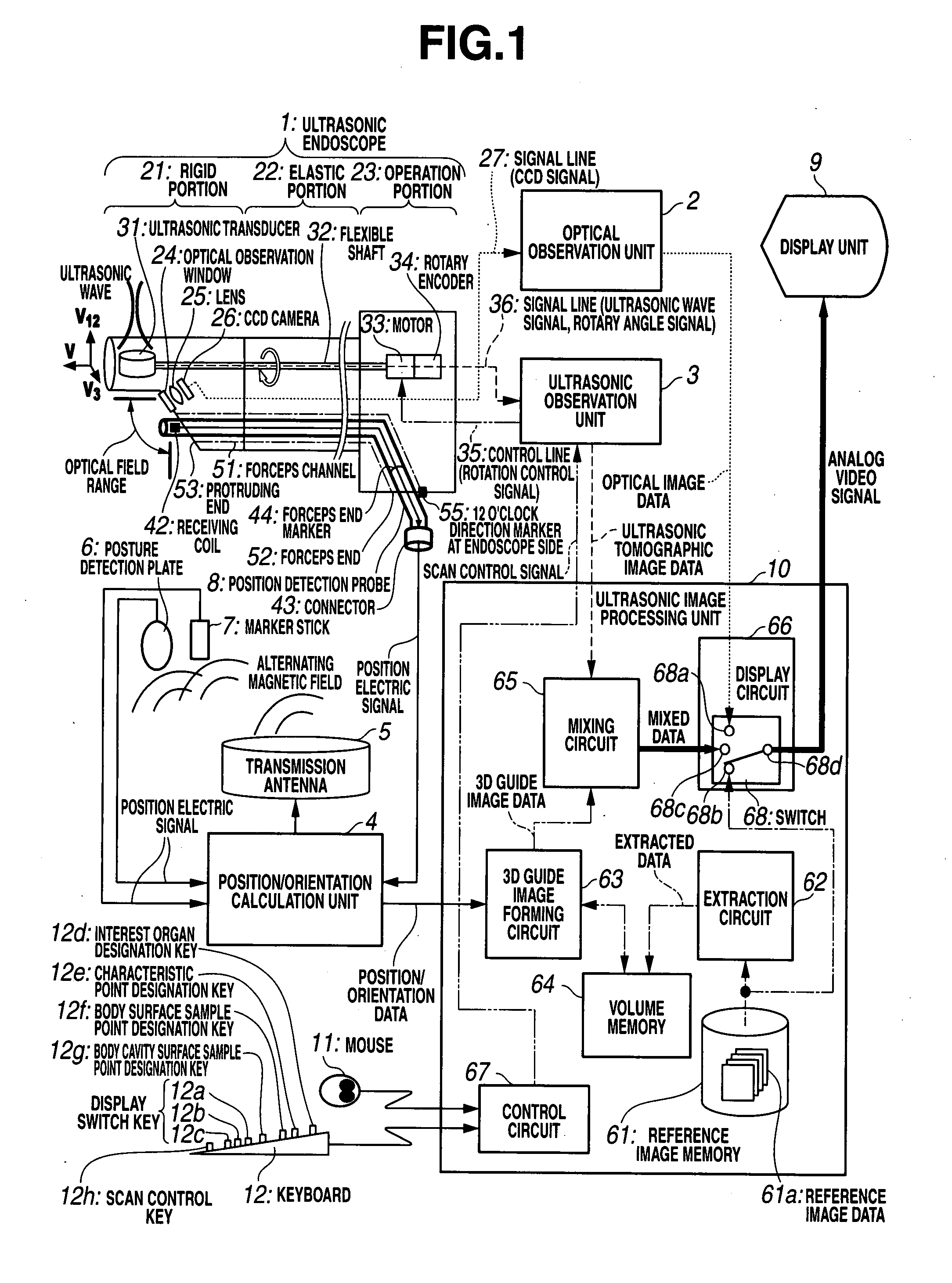 Ultrasonic diagnostic apparatus