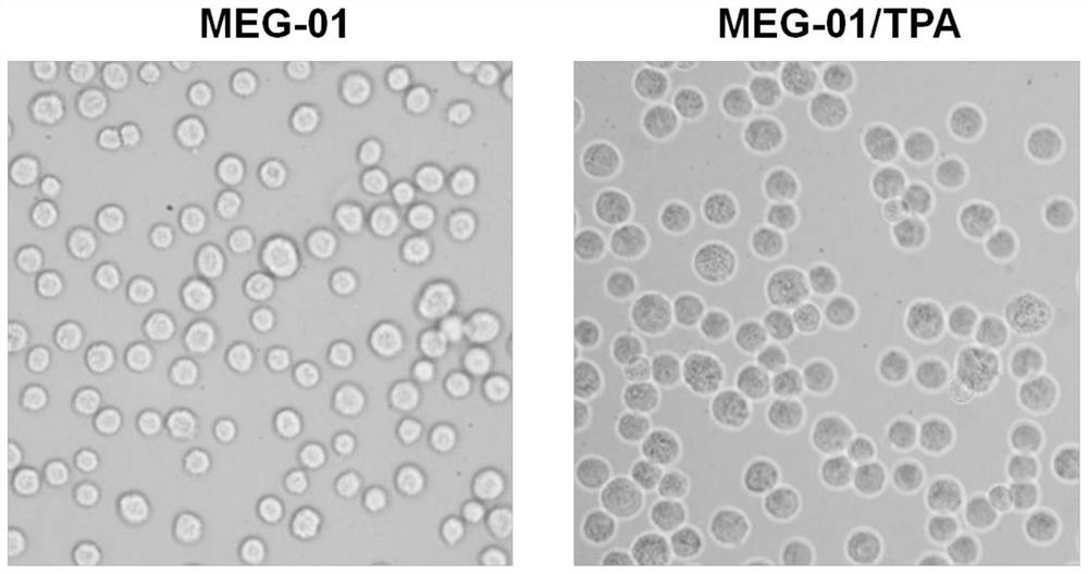 miRNA regulation of platelet gelsolin and its application in screening antiplatelet drugs