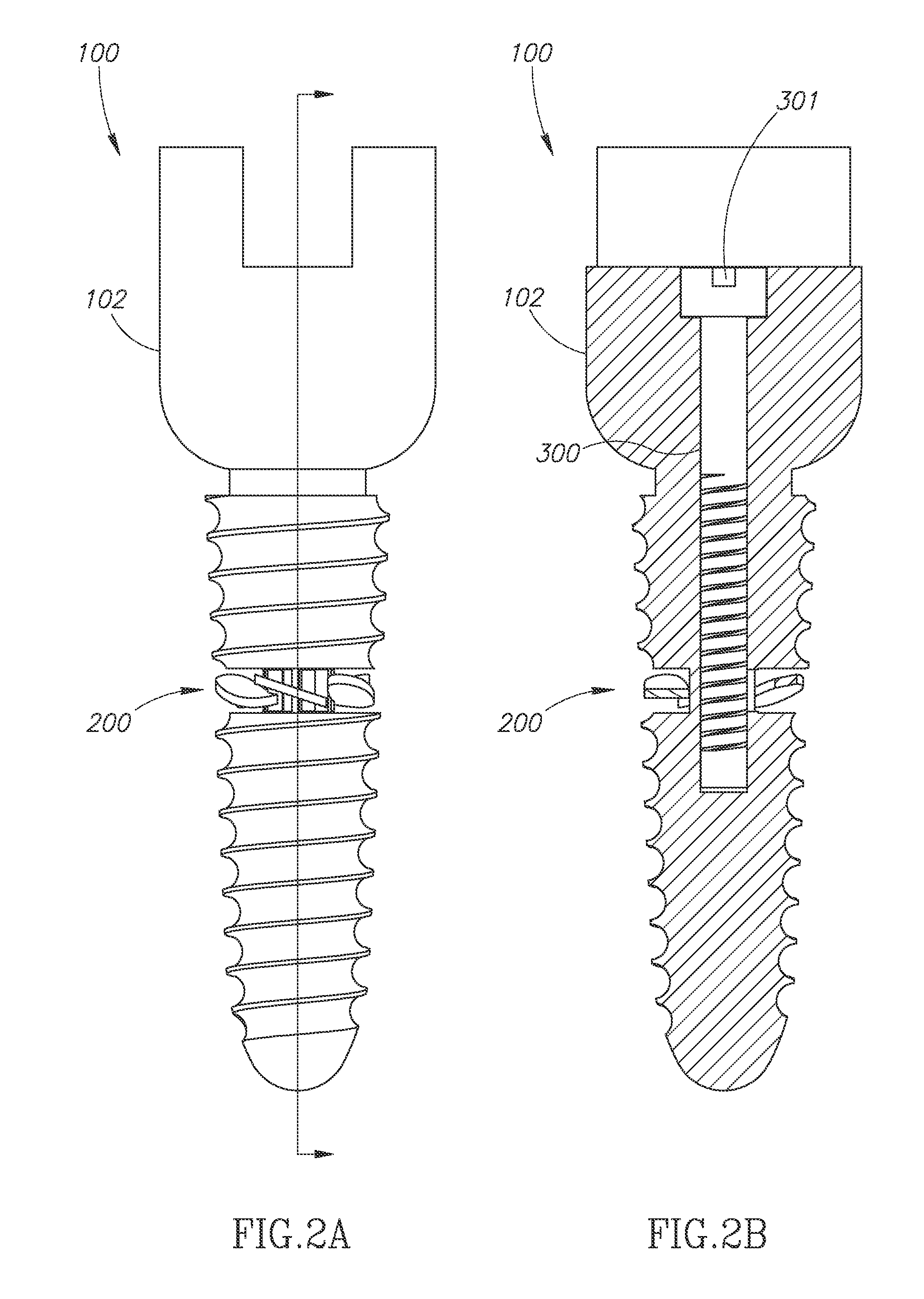 Device for enhanced mechanical stabilization