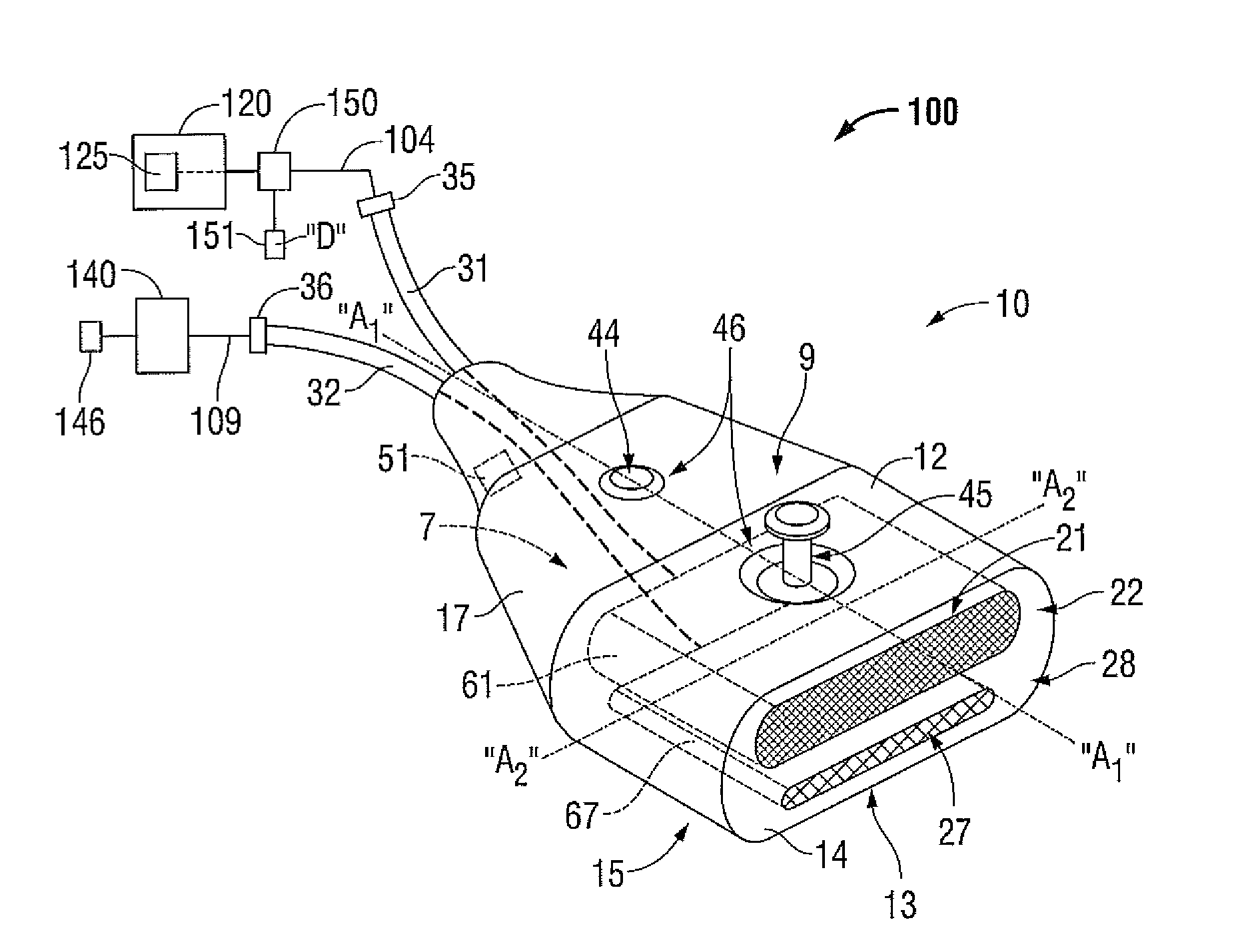 Energy-delivery device including ultrasound transducer array and phased antenna array