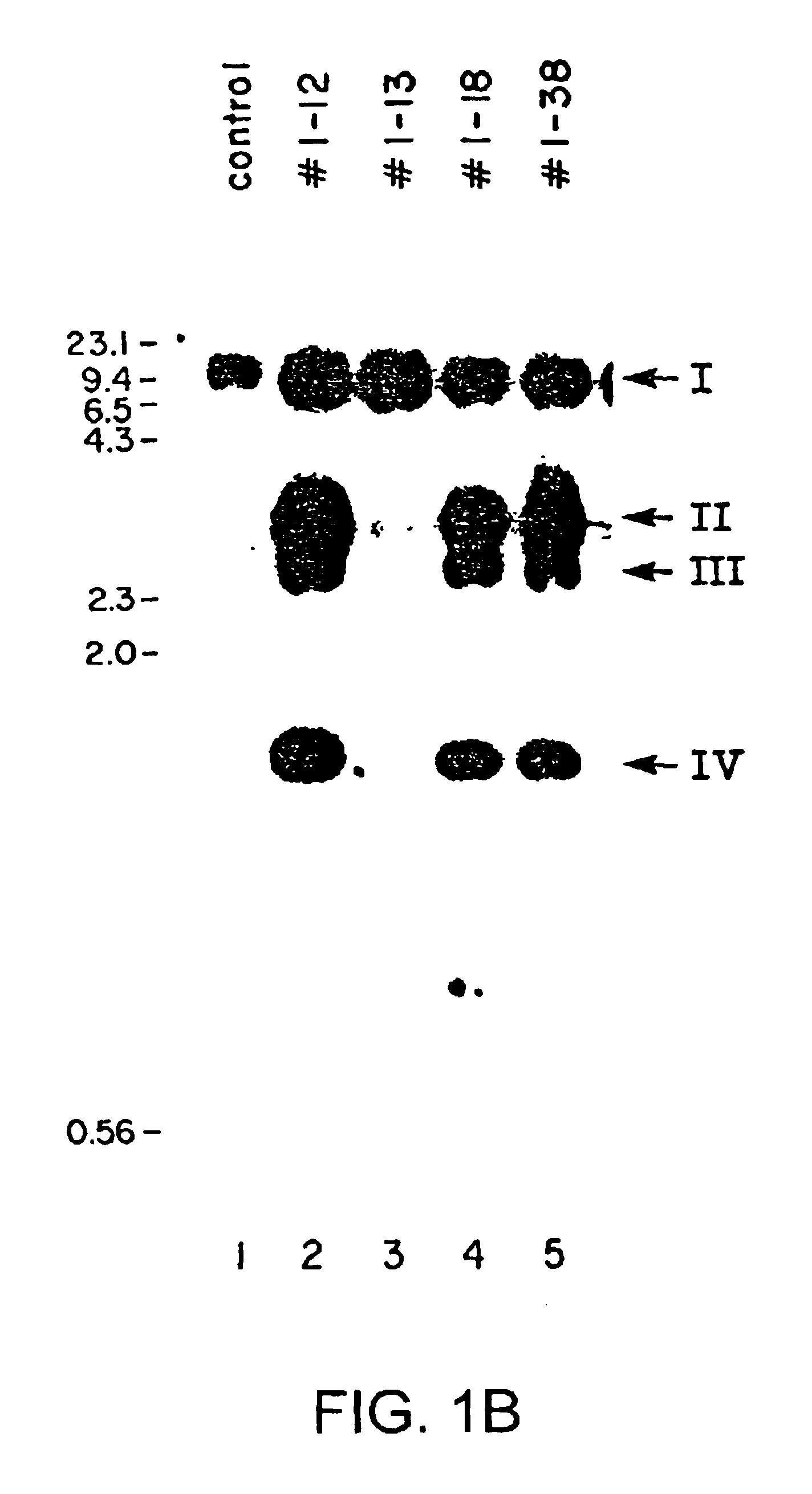 Production of membrane proteins in the milk of transgenic mammals