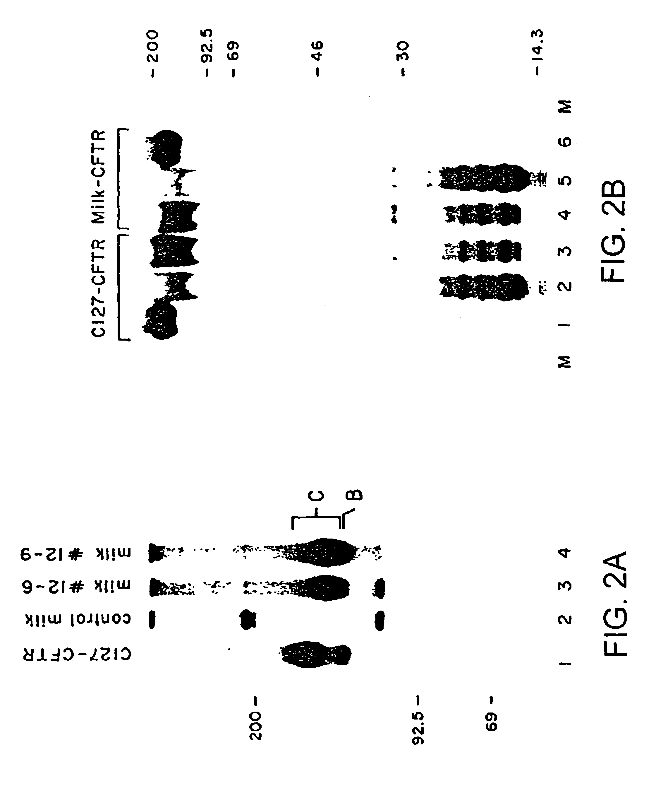 Production of membrane proteins in the milk of transgenic mammals