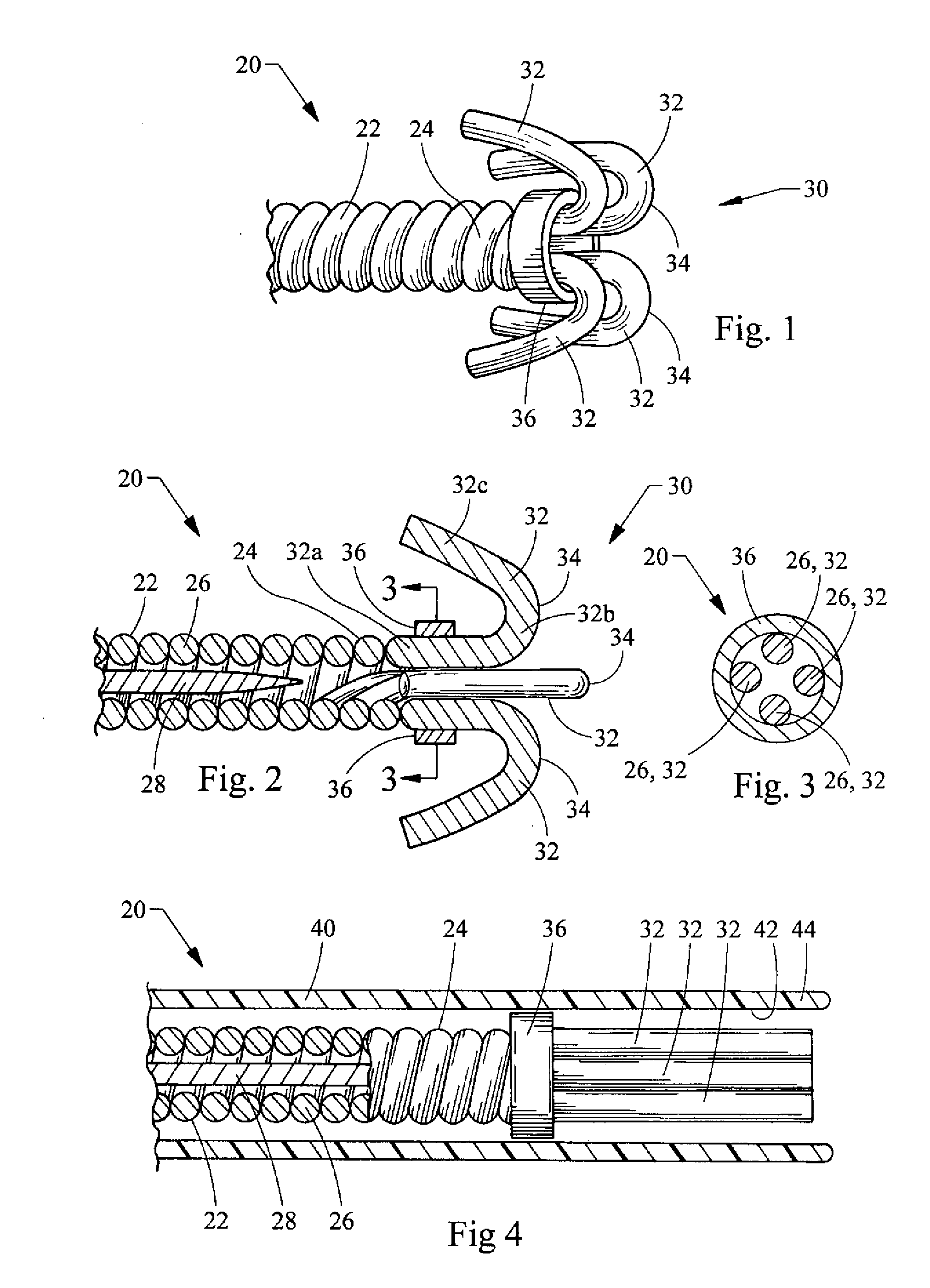 Tassel tip wire guide