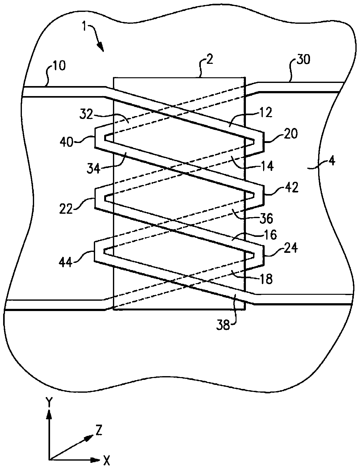 Inductive components used in integrated circuits, transformers and inductors that form part of integrated circuits