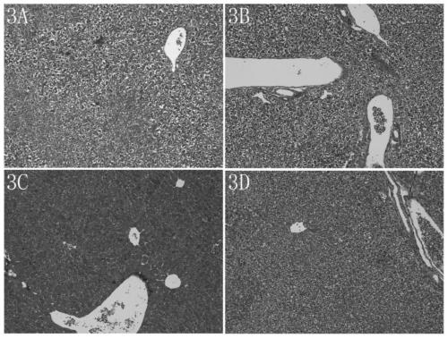 Drugs for the prevention and treatment of alcoholic liver disease