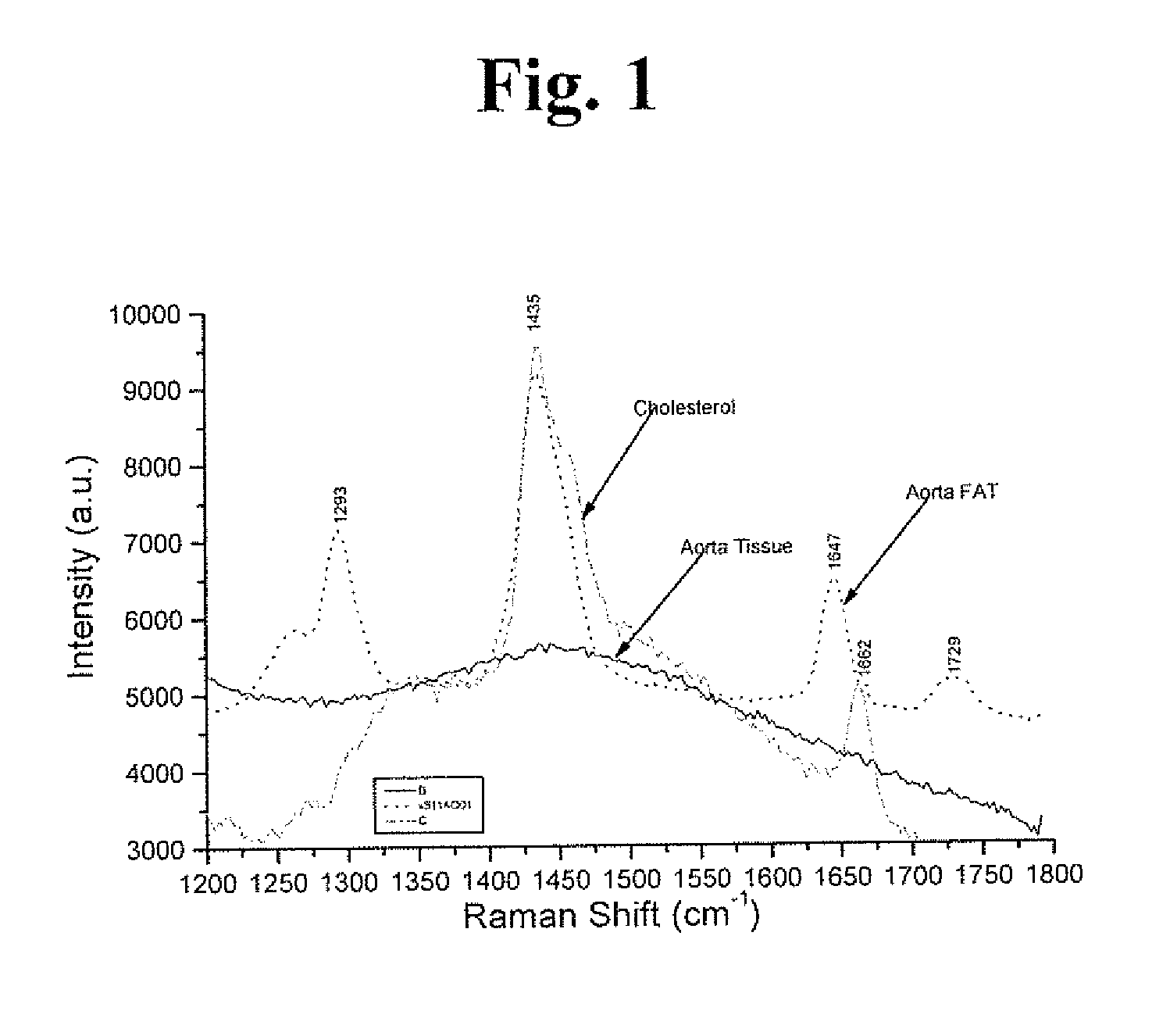 Raman and resonant raman detection of vulnerable plaque optical analyzer and imager