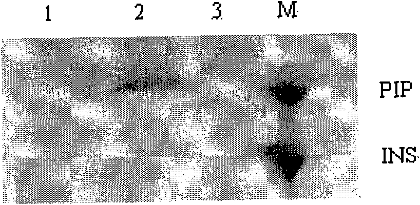 Improved gene construction method and property testing of fast-acting insulin precursor