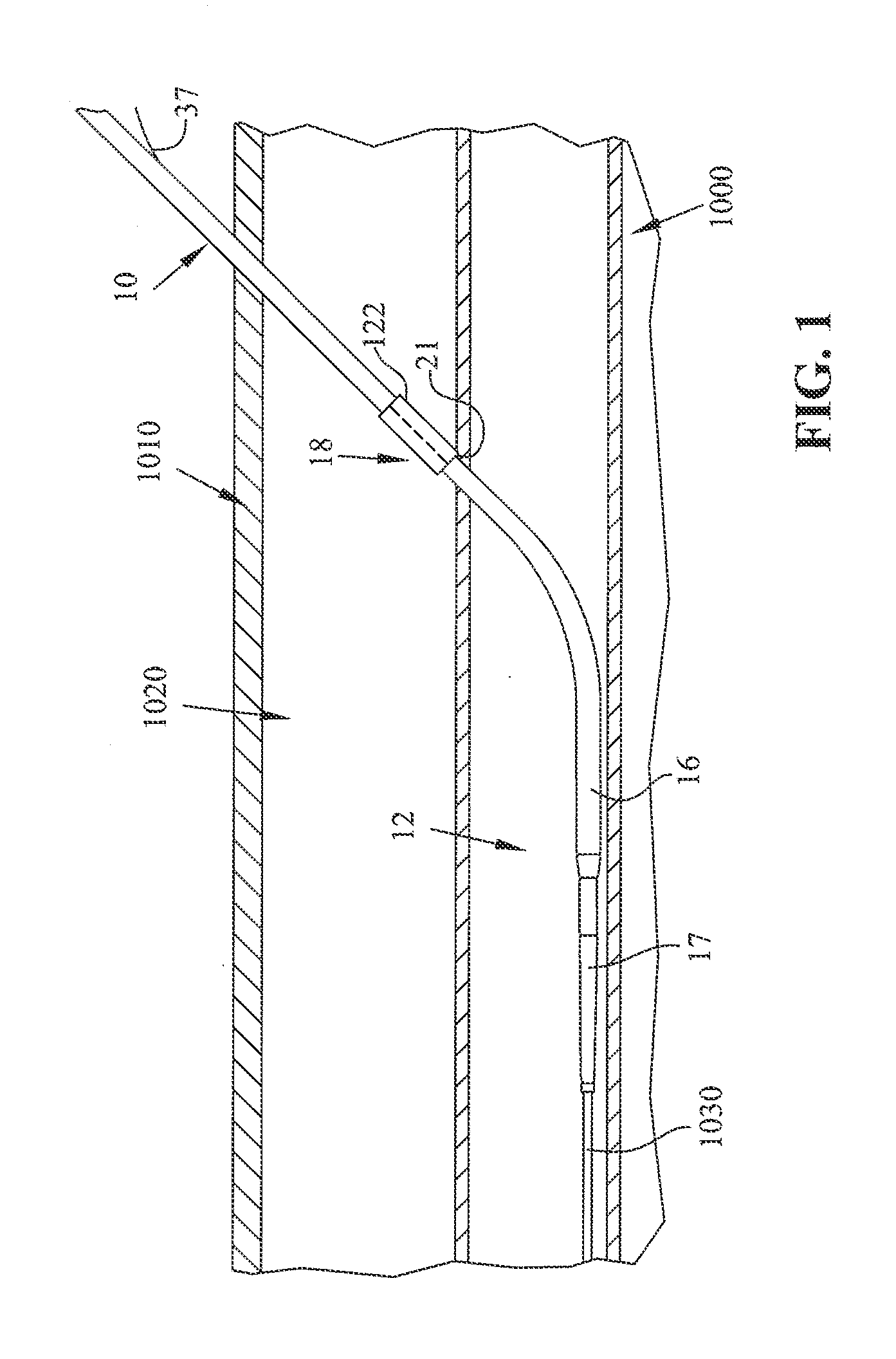 Method and apparatus for sealing access with an Anti-inflammatory infused member