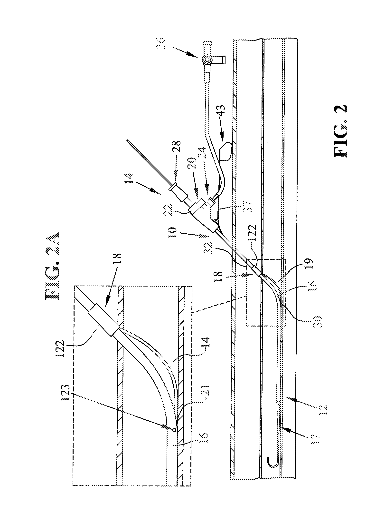 Method and apparatus for sealing access with an Anti-inflammatory infused member