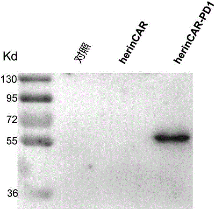 CAR-T cell capable of efficiently and stably expressing inhibiting antibody and application thereof