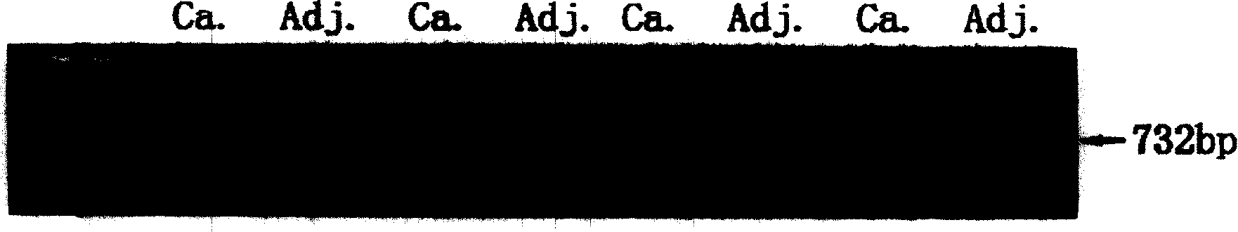 Tumour antigen protein and tumour antigen peptide