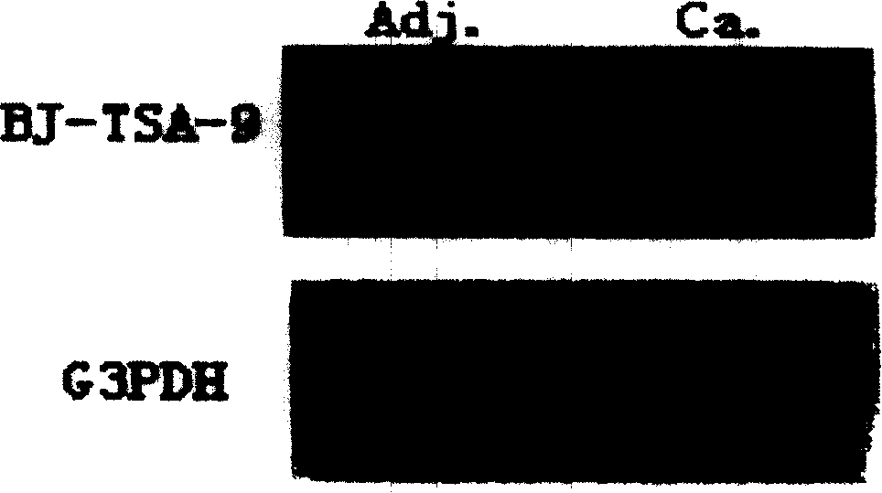 Tumour antigen protein and tumour antigen peptide