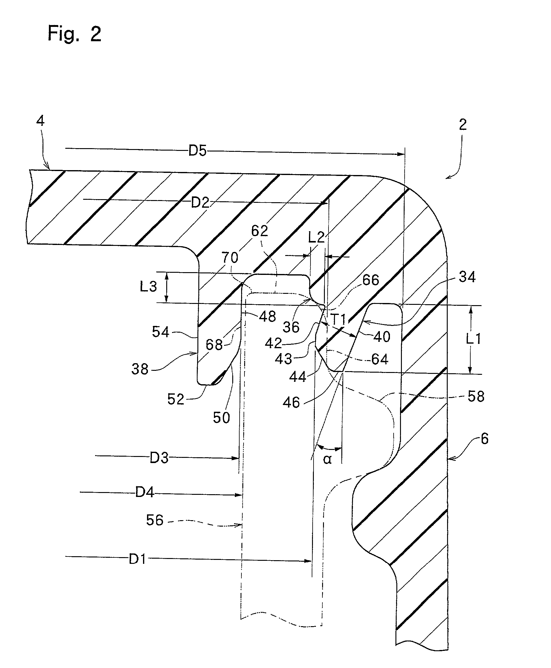 Plastic container closure