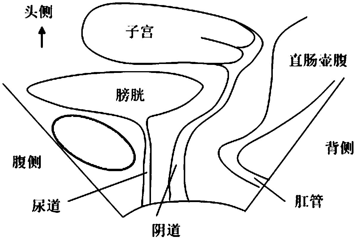 Method and device for plane image processing of levator ani muscle axis