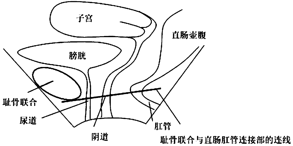 Method and device for plane image processing of levator ani muscle axis