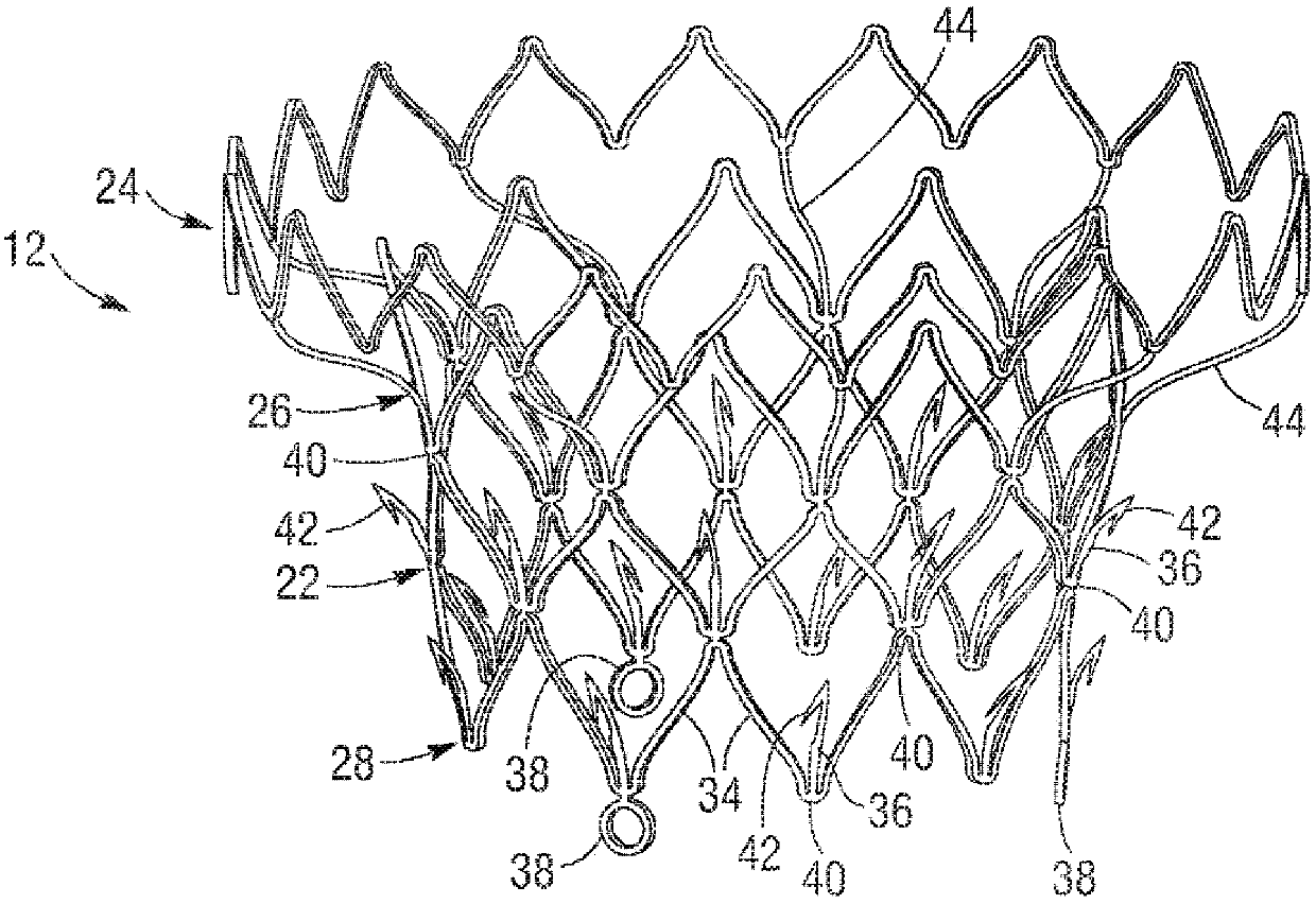 Percutaneous mitral valve replacement device