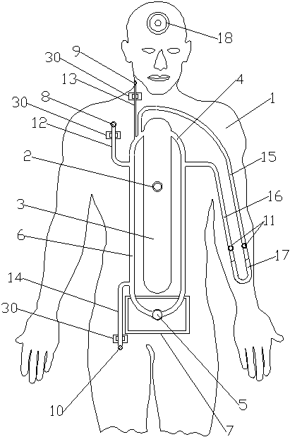 Blood purification model person