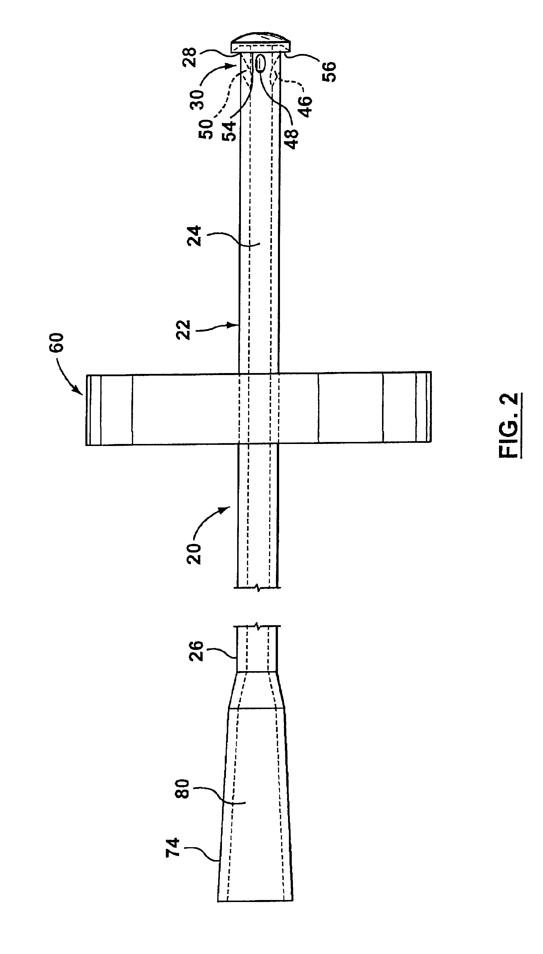 Ear irrigation device