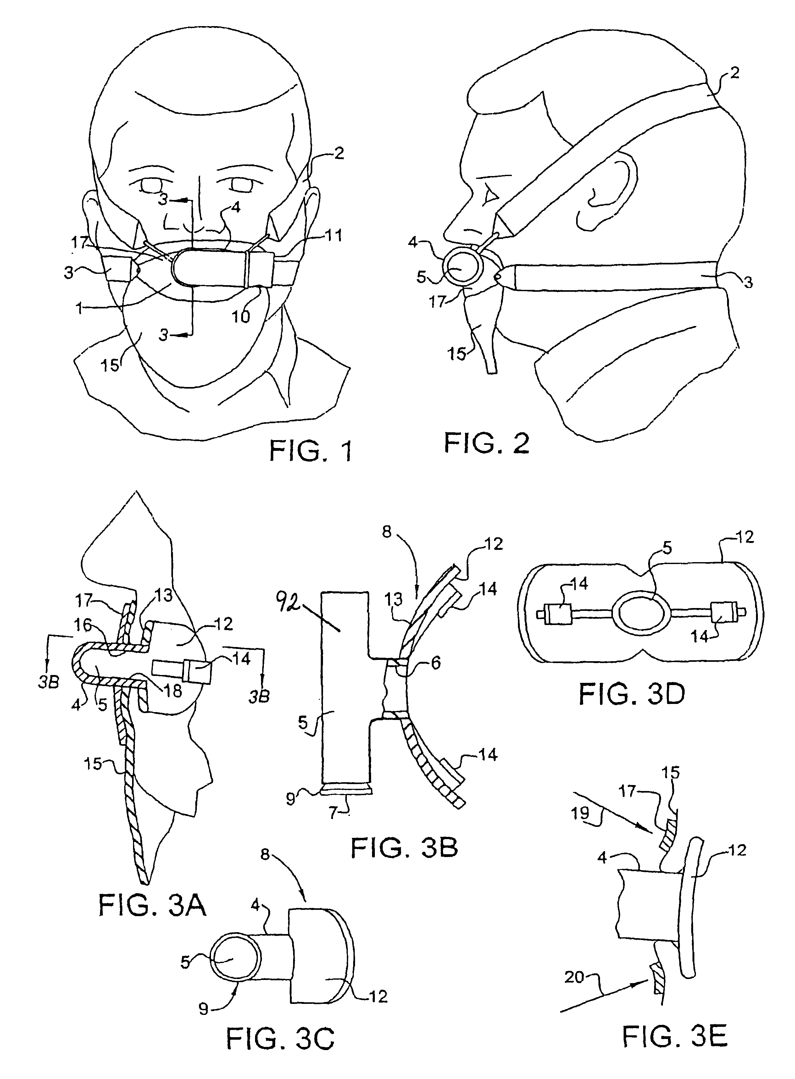 Mouthpiece, nasal seal, head appliance, apparatus, and methods of treating sleep apnea