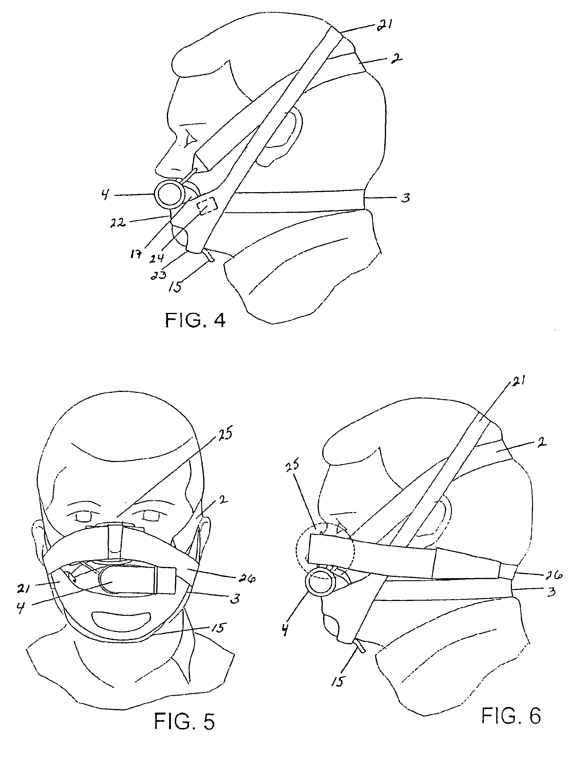 Mouthpiece, nasal seal, head appliance, apparatus, and methods of treating sleep apnea