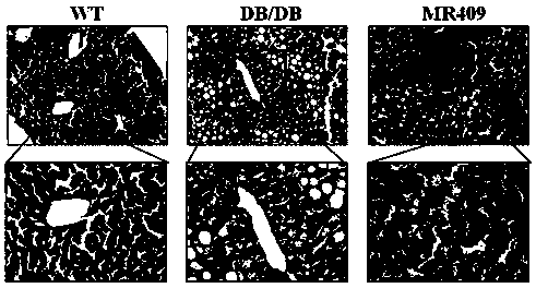 Application of GHRH-A in preparation of medicine for treating non-alcoholic fatty liver diseases