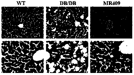 Application of GHRH-A in preparation of medicine for treating non-alcoholic fatty liver diseases