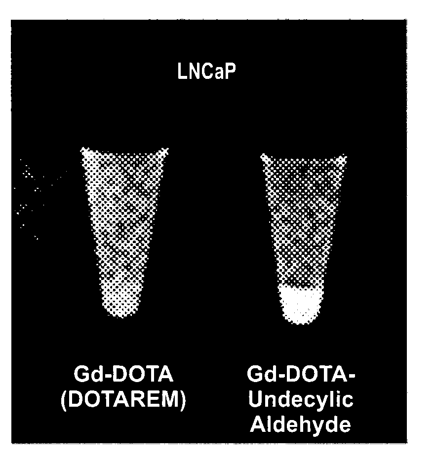 Means for the detection and treatment of prostate cells