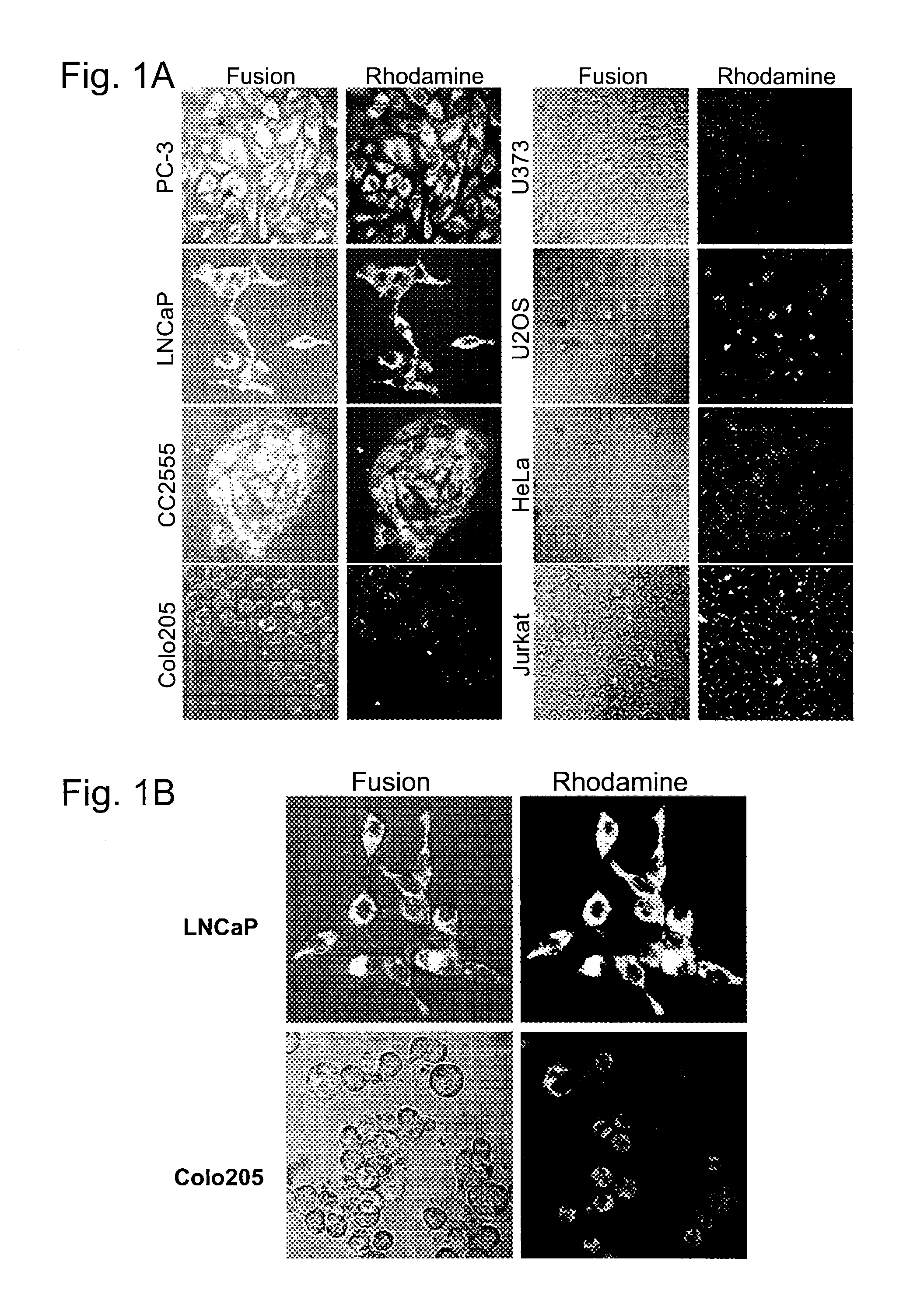 Means for the detection and treatment of prostate cells