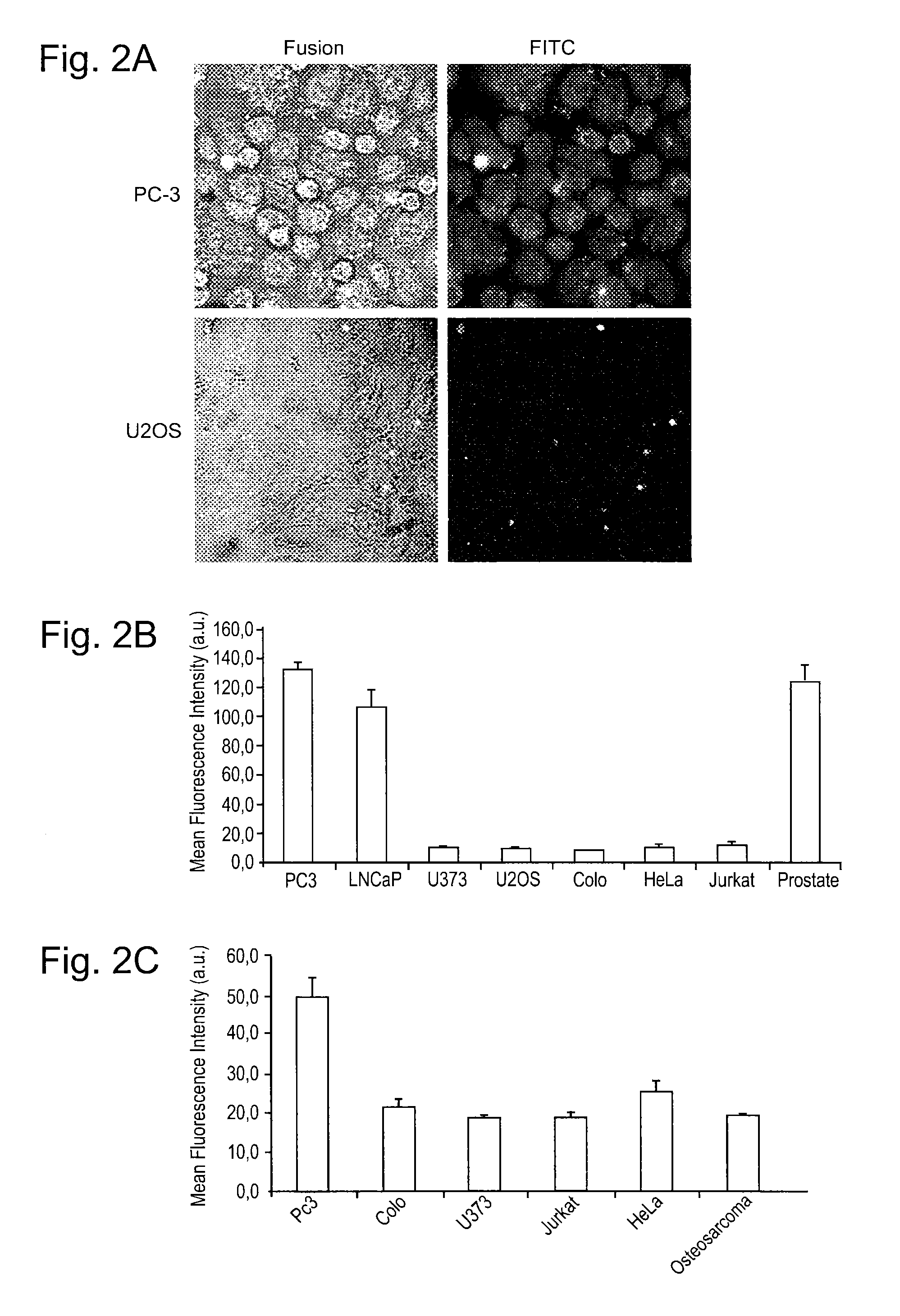 Means for the detection and treatment of prostate cells