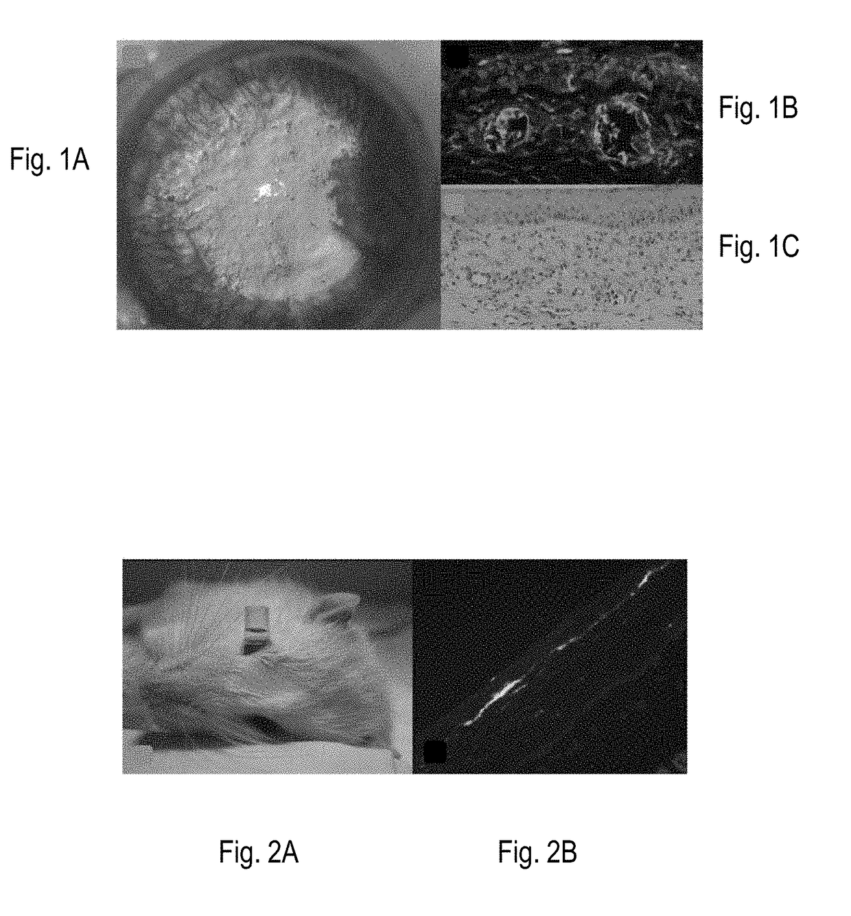 Protein therapy for treatment of retinal diseases