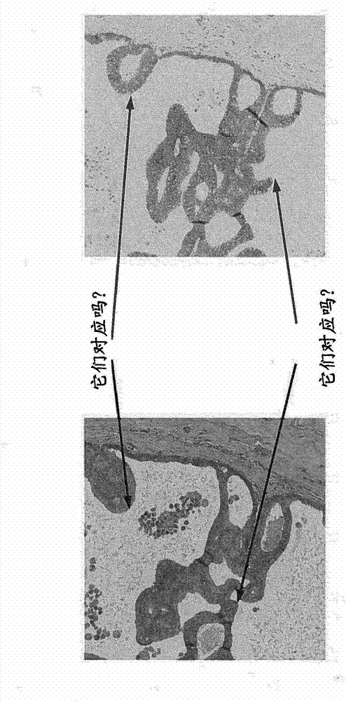 Automatic image alignment