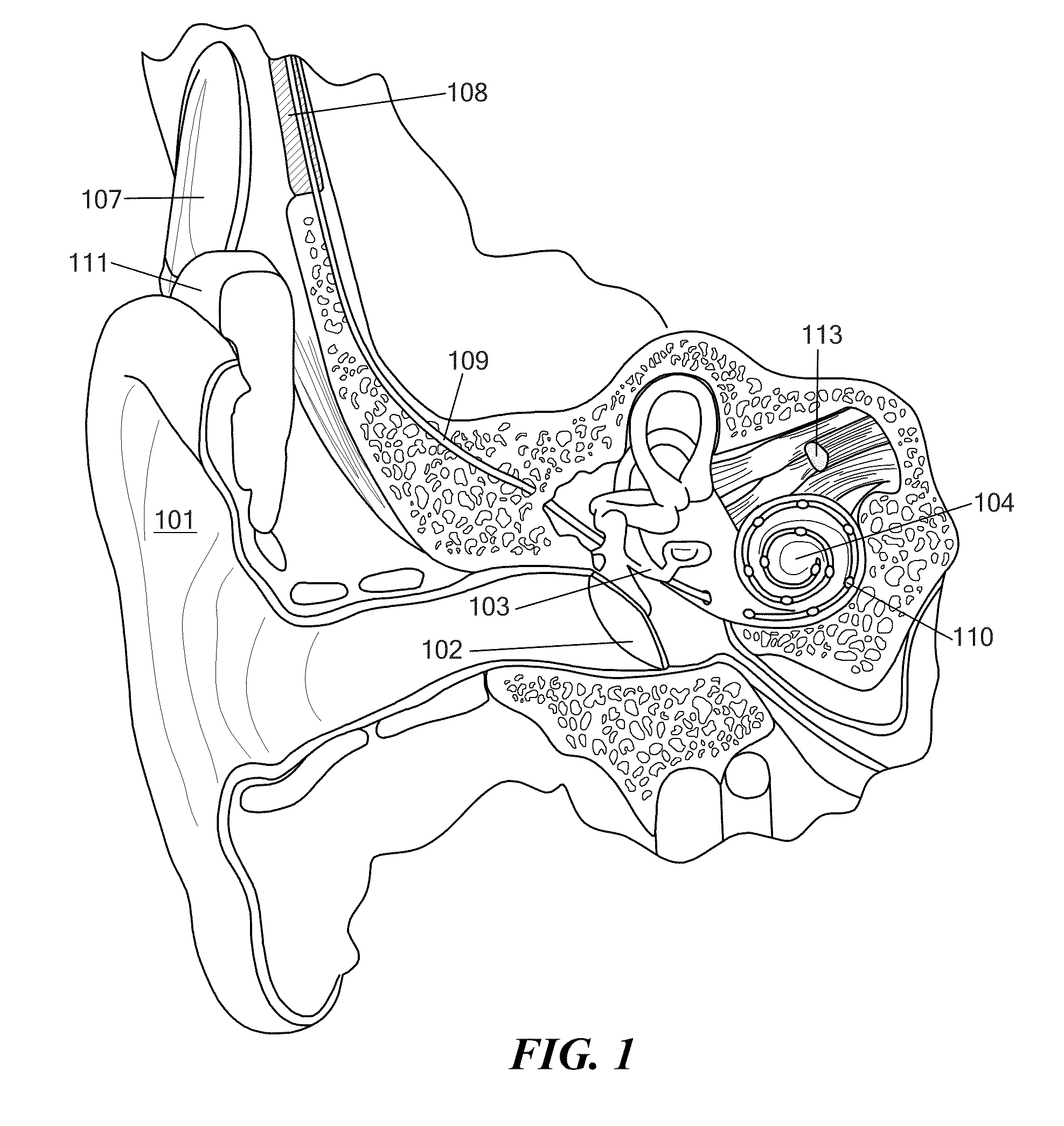 Inductive Link with Ferrite Sheets