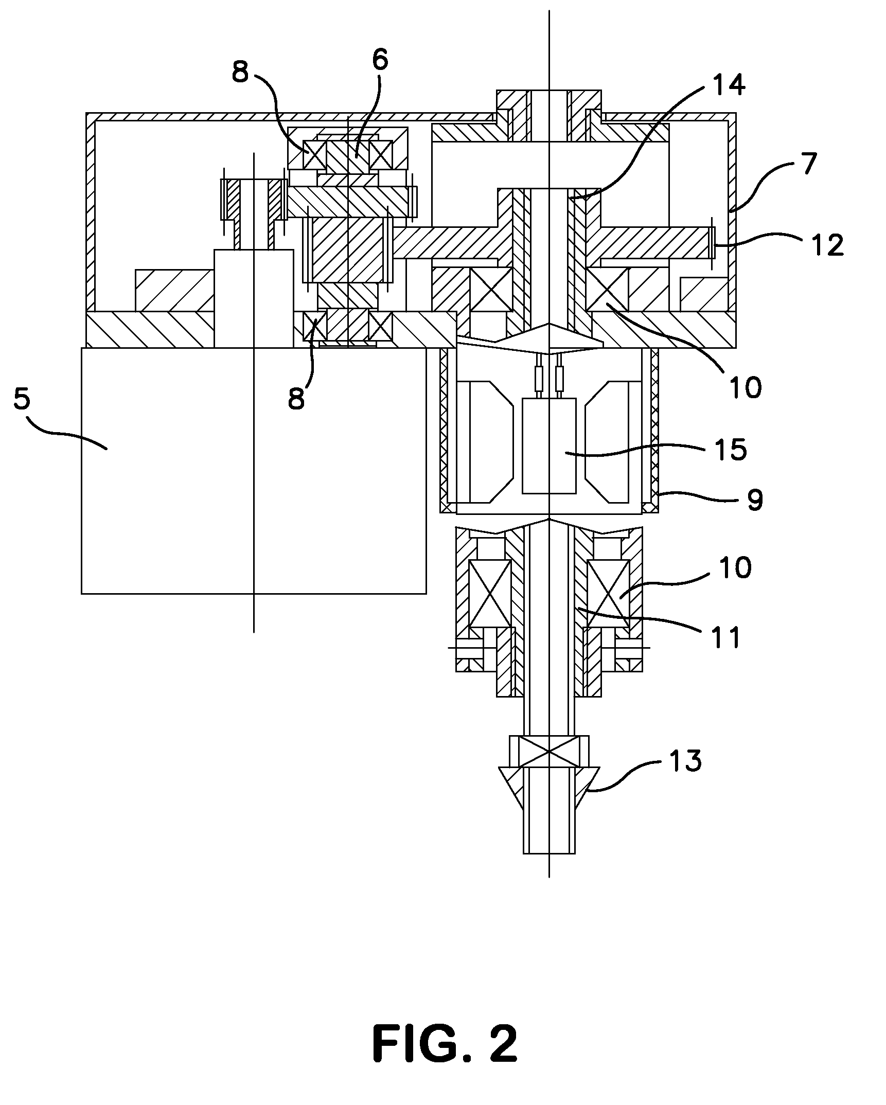 Computer-Aided System for Limb Lengthening