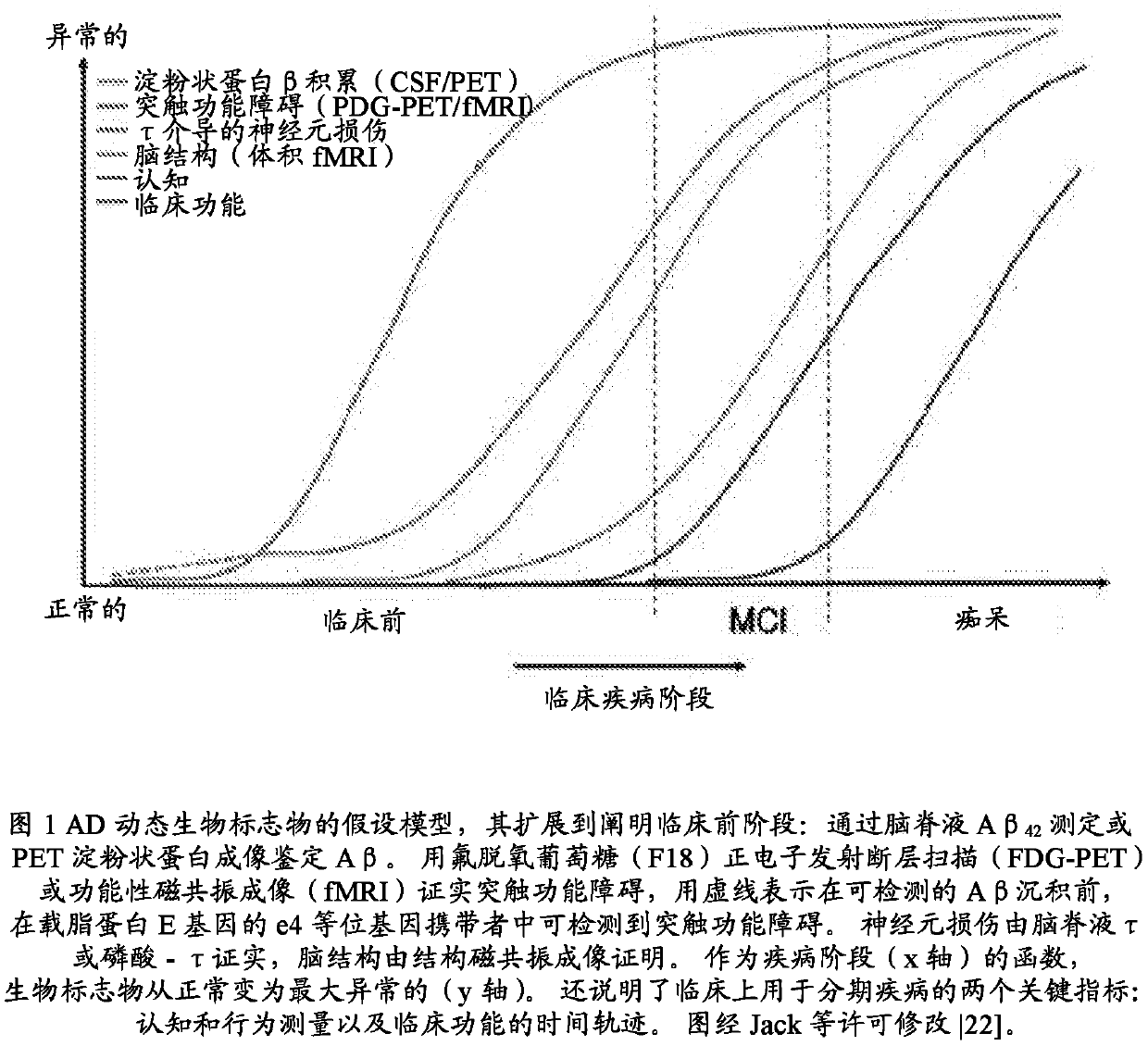 Galantamine clearance of amyloid-beta