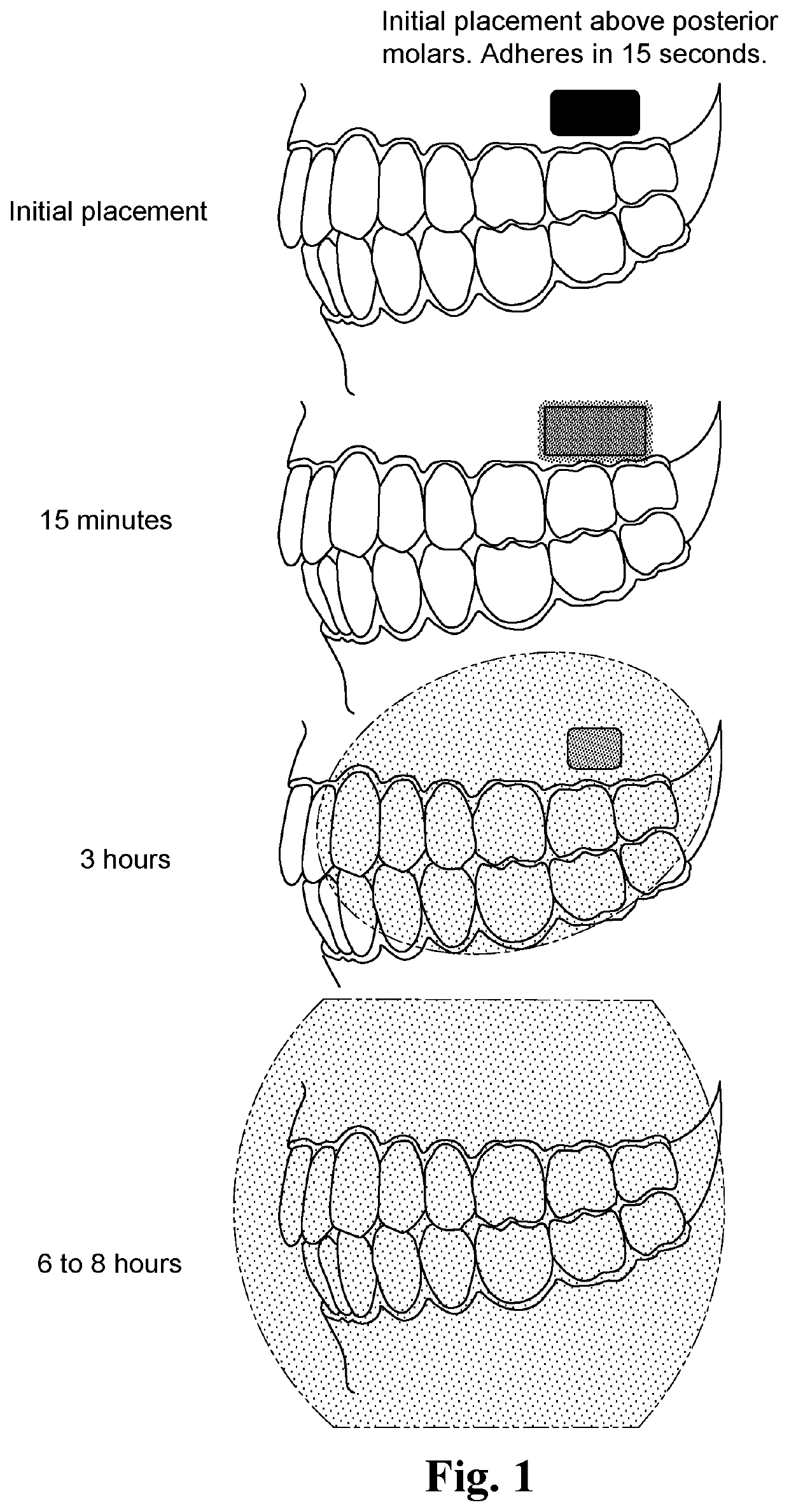 Adherent oral pharmabiotic delivery strip