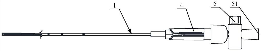 Sacculus and device for removing calculus under choledochoscope