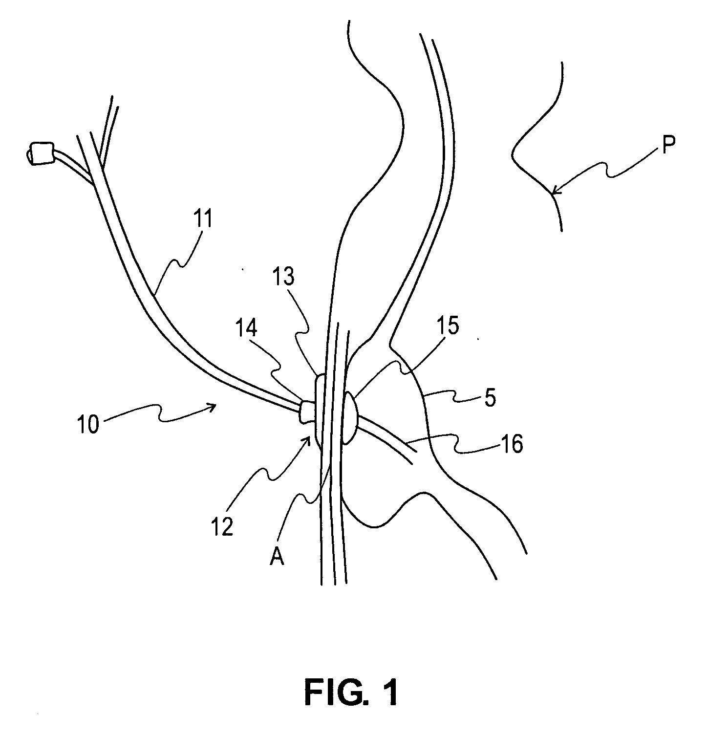 G-tube retainer