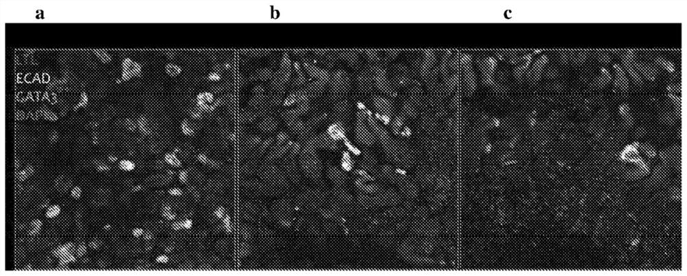 Differentiation of pluripotent stem cells forming nephronoids