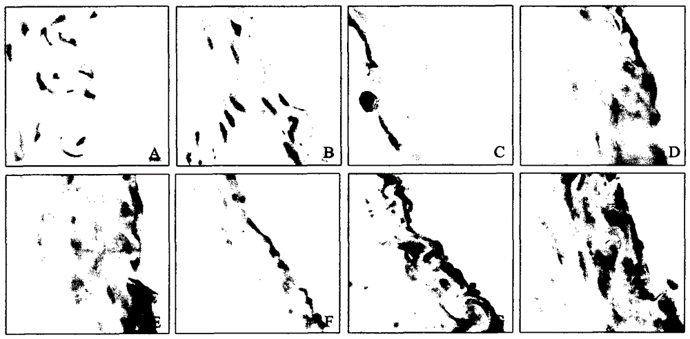 Pharmaceutical composition for treating essential hypertension and application thereof