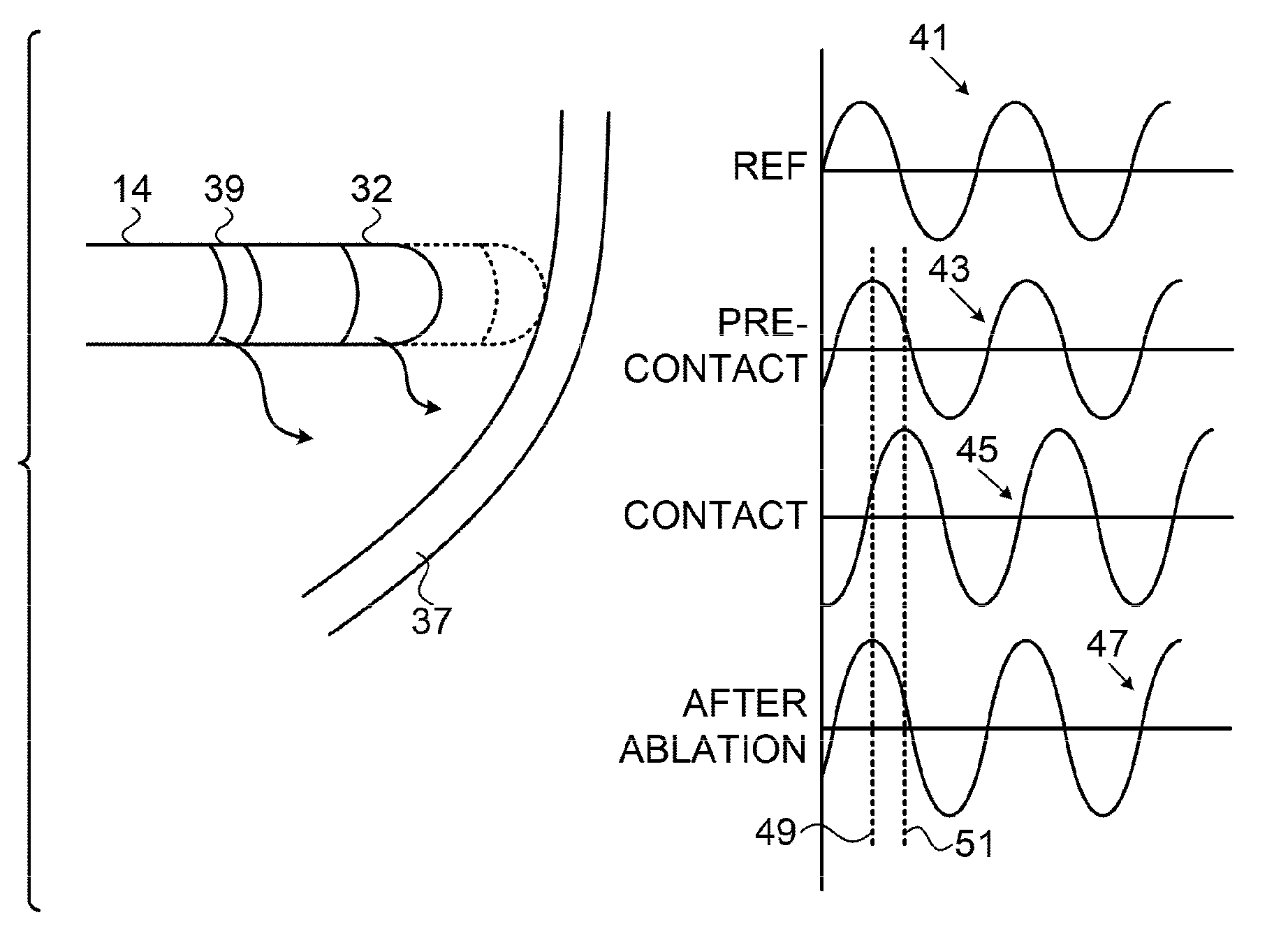 Contact assessment based on phase measurement