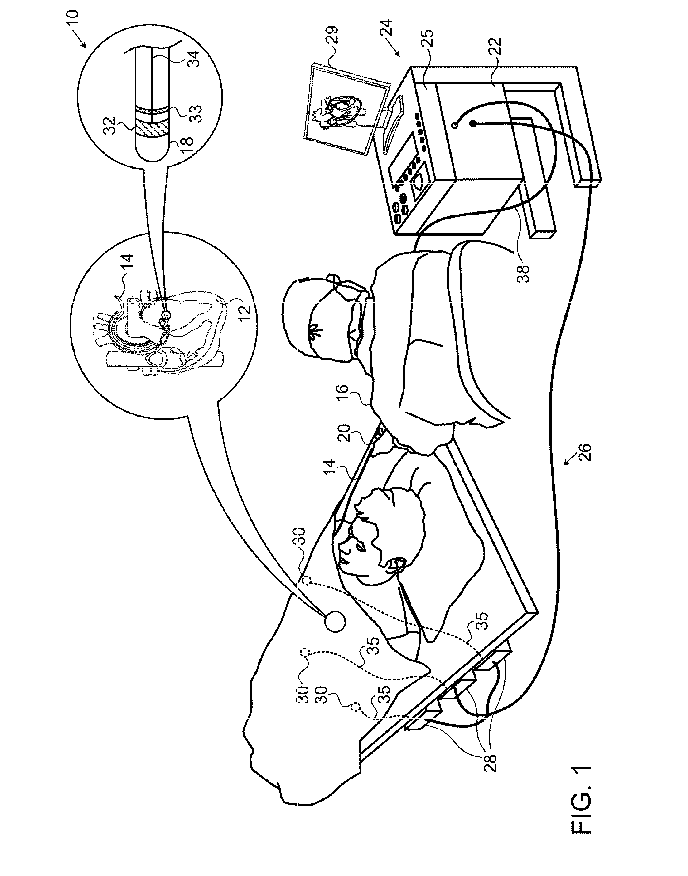 Contact assessment based on phase measurement