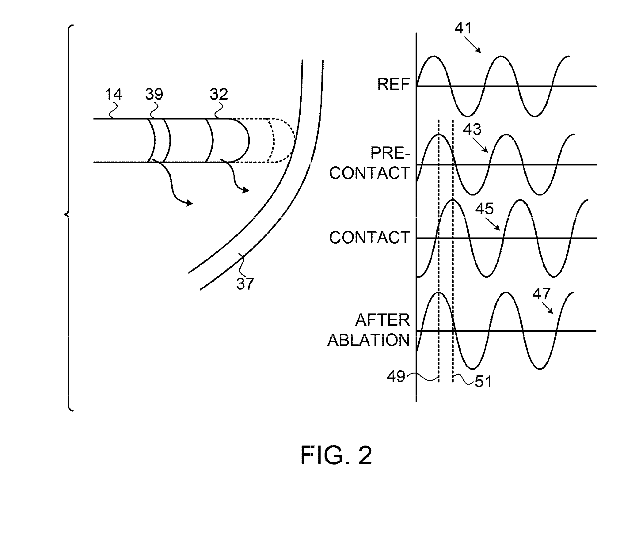 Contact assessment based on phase measurement