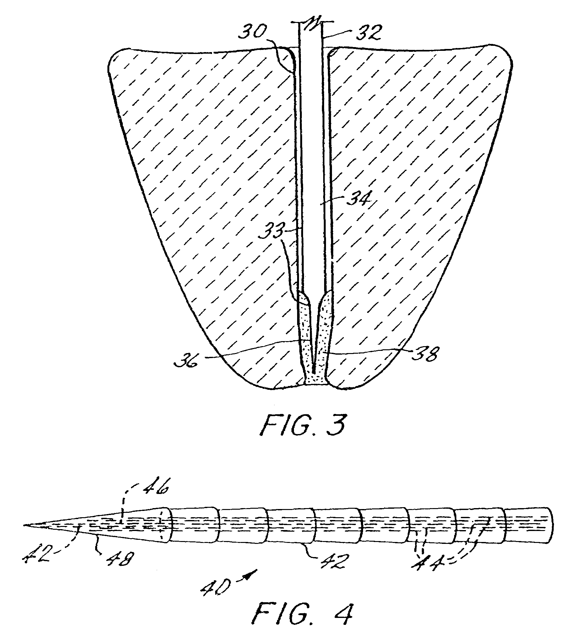 Endodontic post and obturating system