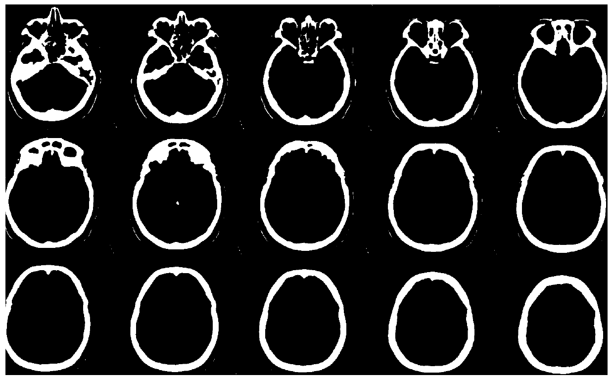 Age estimation method based on deep learning