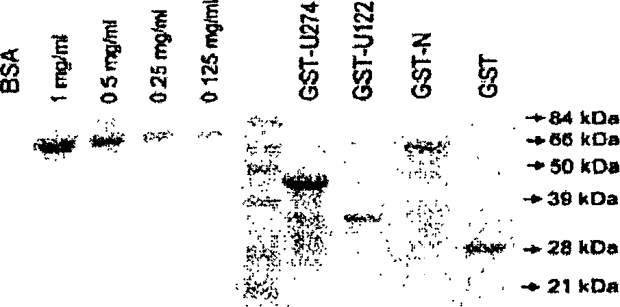 Method of diagnosing SARS corona virus infection